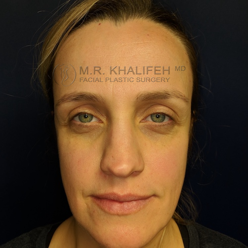 Maker:0x4c,Date:2017 11 19,Ver:4,Lens:Kan03,Act:Lar01,E Y