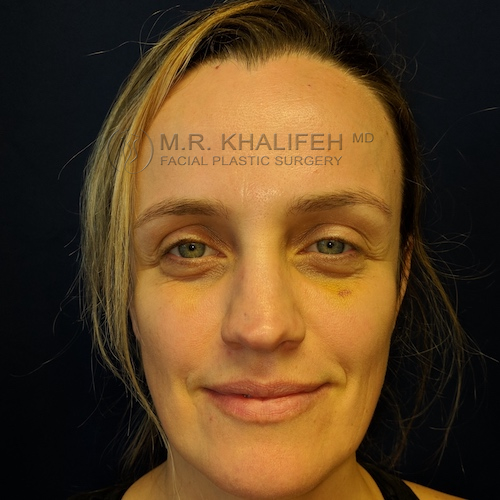 Maker:0x4c,Date:2017 11 19,Ver:4,Lens:Kan03,Act:Lar01,E Y