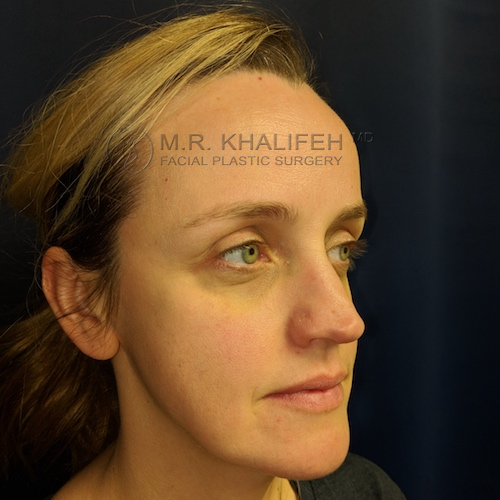 Maker:0x4c,Date:2017 11 19,Ver:4,Lens:Kan03,Act:Lar01,E Y