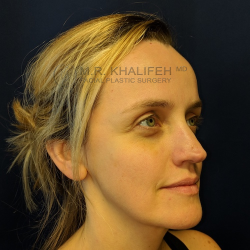 Maker:0x4c,Date:2017 11 19,Ver:4,Lens:Kan03,Act:Lar01,E Y