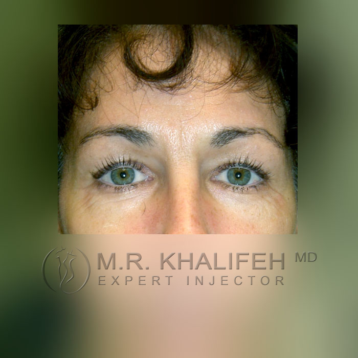 1584048827 6844c172 54c1 4d5a b3de cb83bc1075e5.jpg