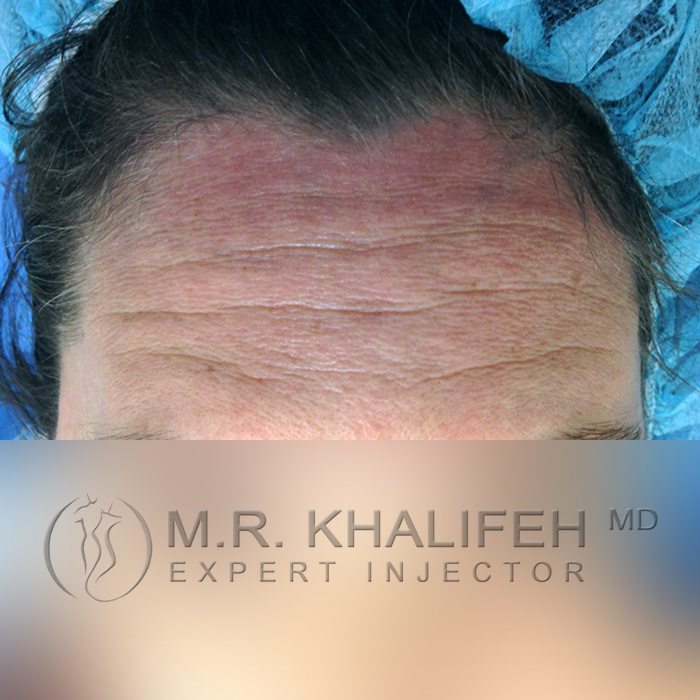 1584048854 a842d2b5 993b 4abf aa1f 85a91e4a1d35.jpg