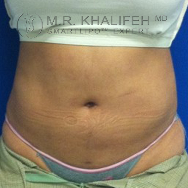 1584057436 eb262b58 cf98 4cbb 9c2a 52d6f539ee4f.jpg