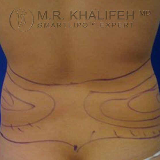 1584057444 15fc51f4 a711 4045 be50 ef1a078f124c e1695823151234.jpg