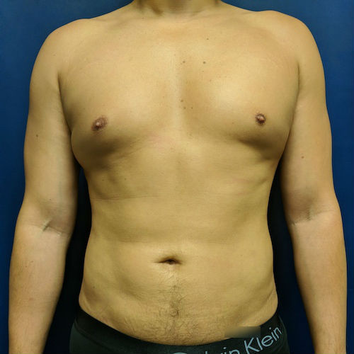 1584119361 7f712be3 48a7 4213 a96a daa2abebc29b.jpg