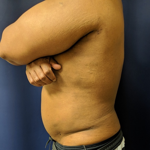 1584119437 9ca014ad 4464 414c aaa4 04cbab5201a5.jpg