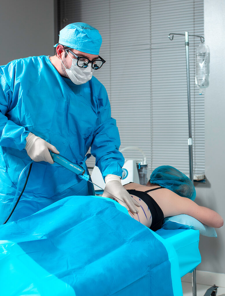 1584120507 laser liposuction
