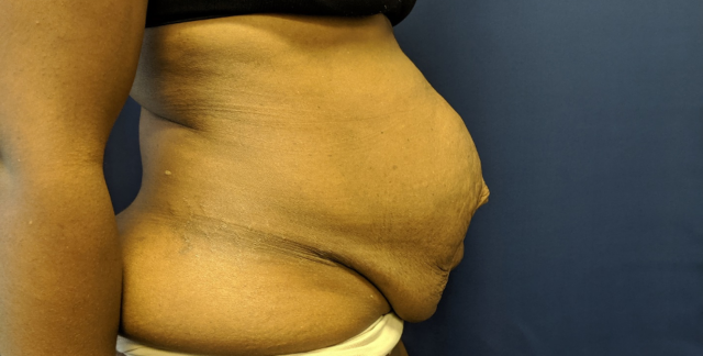 1590182248 tummyside 640x324