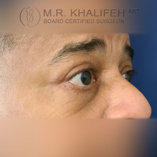 1621351165 2 after.jpg