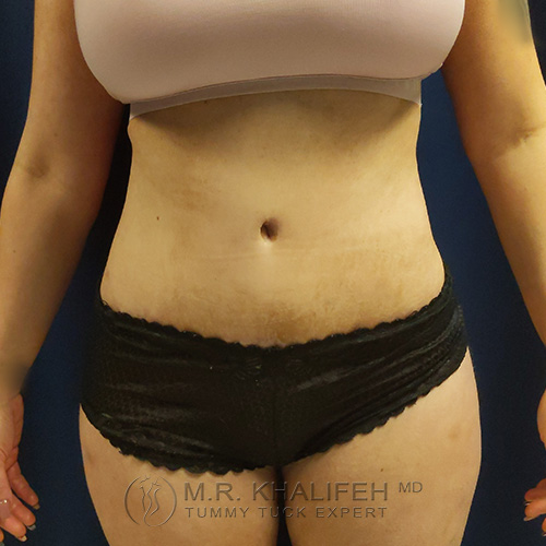 1621351672 1 after.jpg