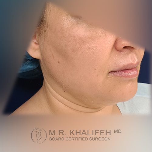 1622731266 2 before.jpg