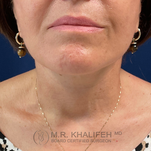 1630356082 1 after 1.jpg