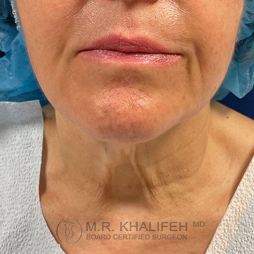 1630356089 1 before 1.jpg