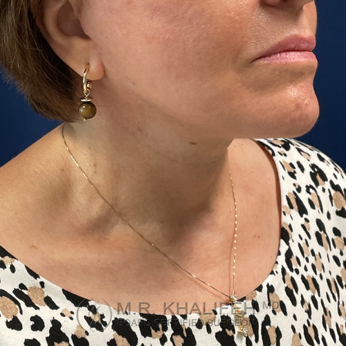 1630356094 2 after.jpg