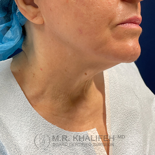 1630356098 2 before 1.jpg