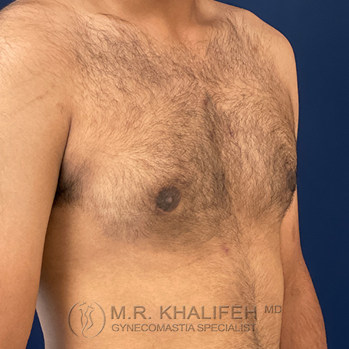 1630356718 2 after.jpg
