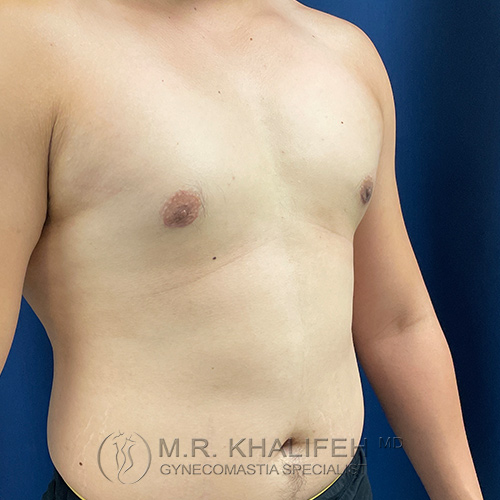 1630356974 2 after.jpg