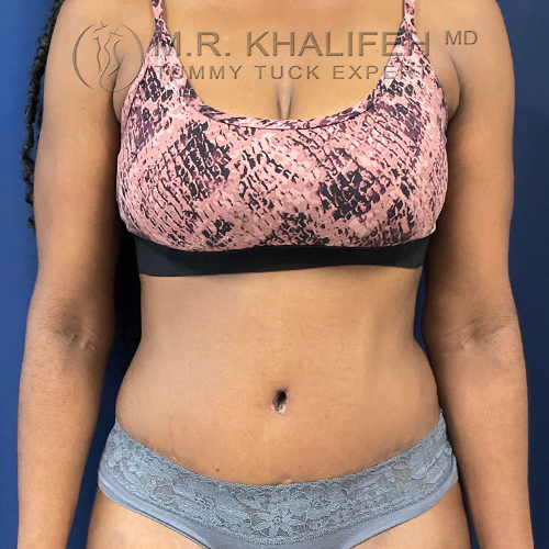 1631131305 1 after.jpg