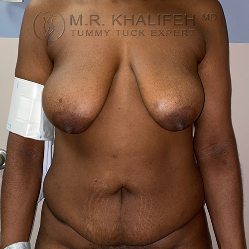 1631131312 1 before.jpg