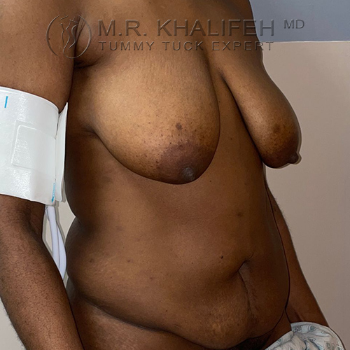 1631131321 2 before.jpg