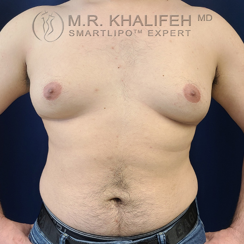 1632864649 1 before 1.jpg