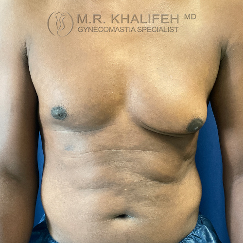 1634673217 1 before.jpg