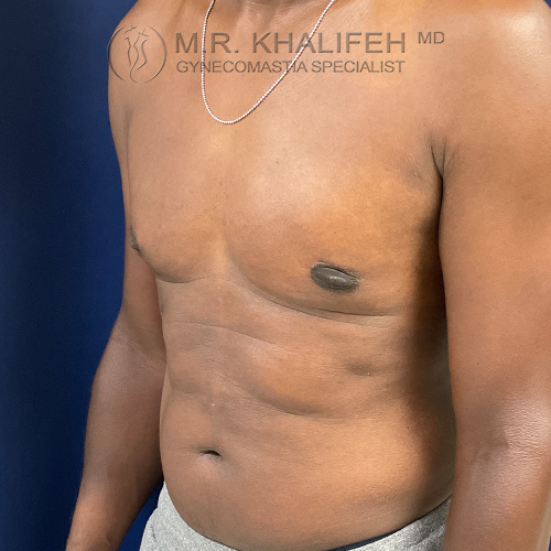 1634673223 2 after.jpg