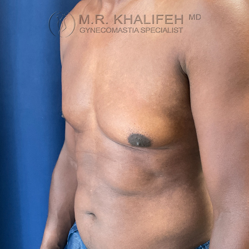 1634673227 2 before.jpg