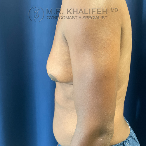 1634673236 3 before.jpg