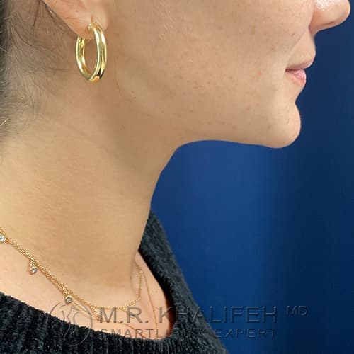 1637185199 2 after.jpg
