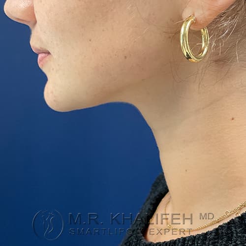1637185205 3 after.jpg
