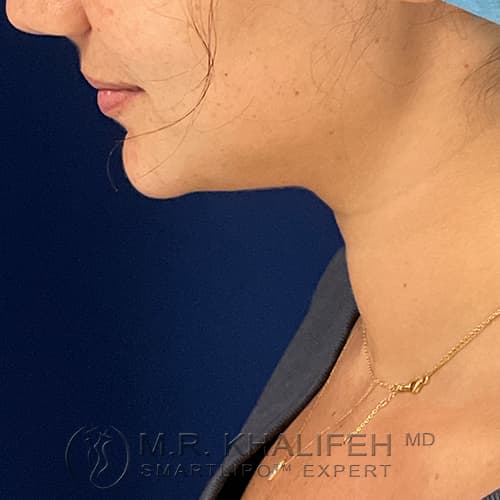 1637185209 3 before.jpg
