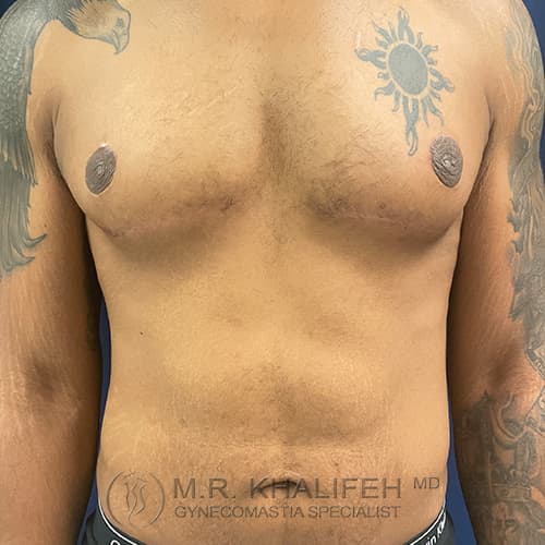 1637185408 1 after.jpg