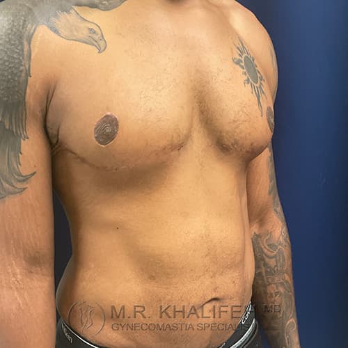 1637185417 2 after.jpg