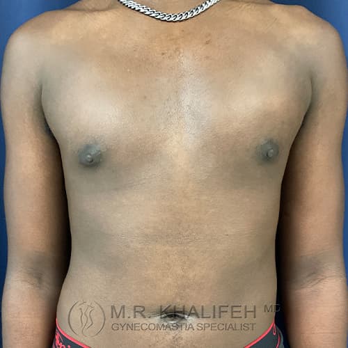 1642605796 1 after.jpg