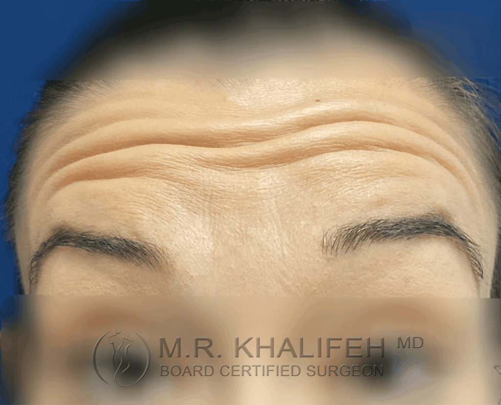 1646343173 before1.png