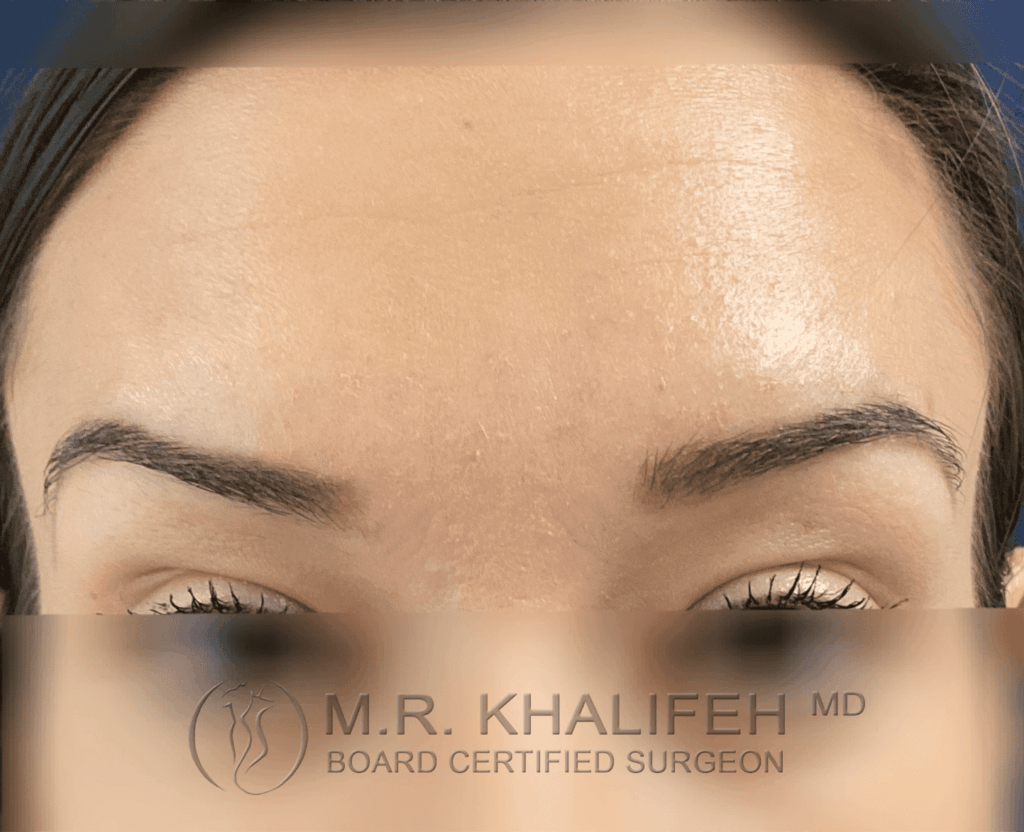 1646343181 after1.png