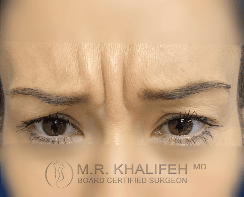 1646343186 before2.png