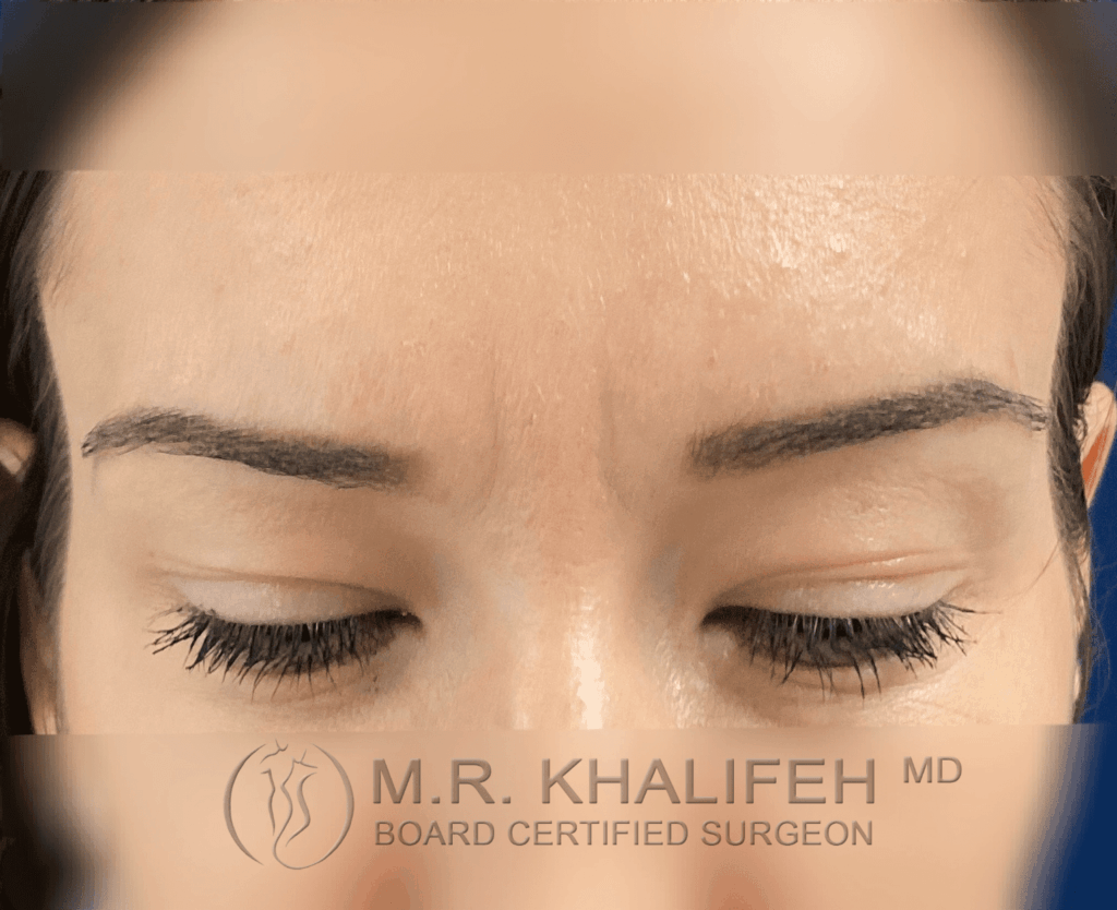 1646343190 after2.png