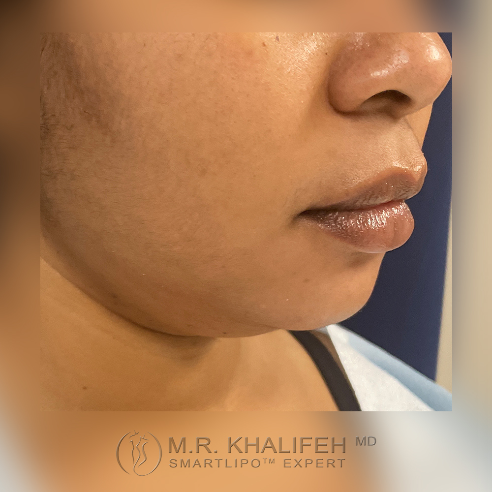 1648650413 2before 1.jpg