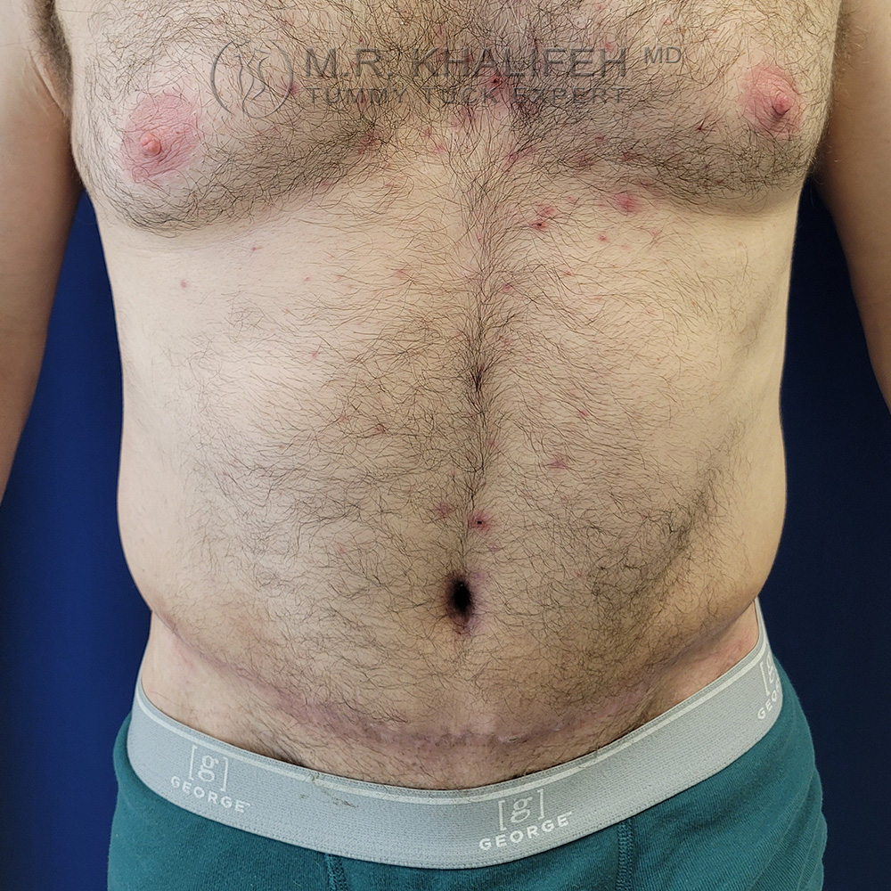 1648737576 2after 1.jpg