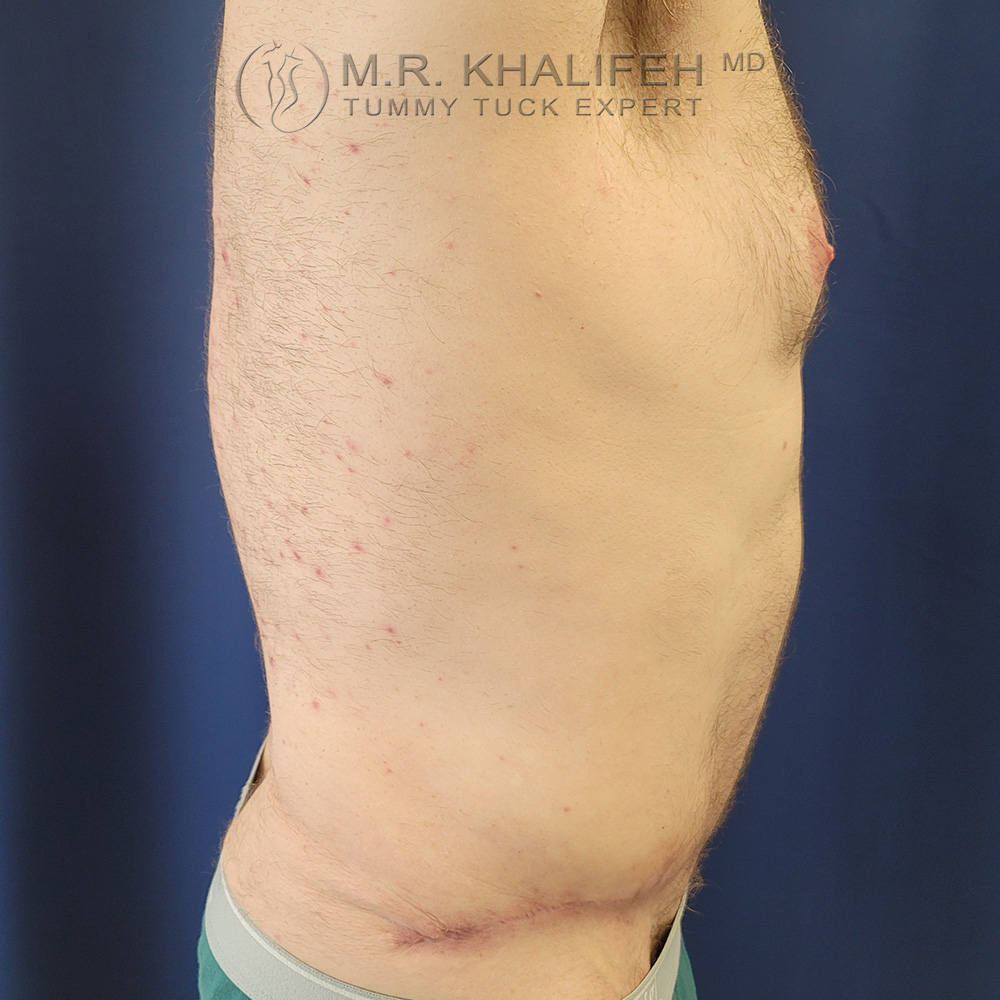 1648737583 4after 1.jpg