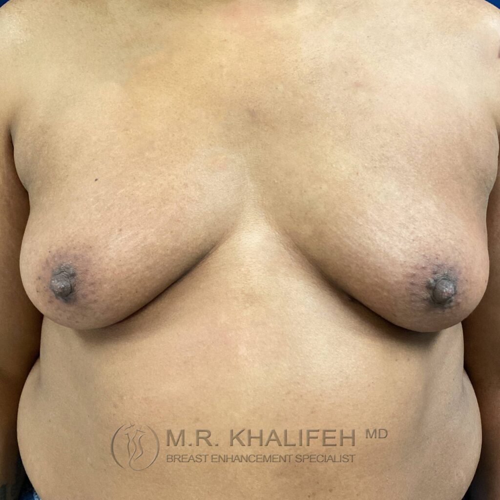 1655234544 pre 1 1 scaled 1.jpg
