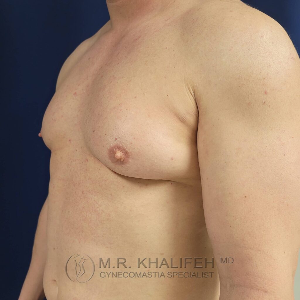 1655235166 pre 2 2 1 scaled 1.jpg