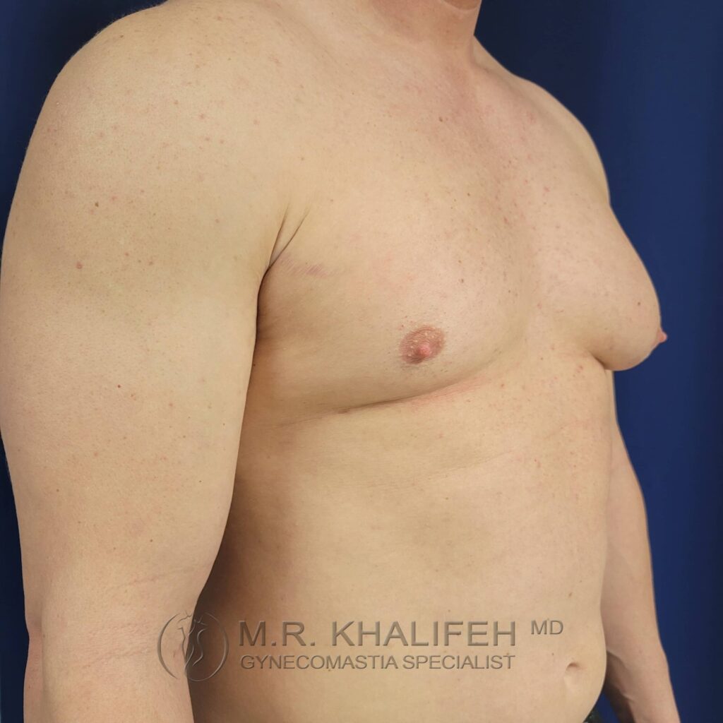 1655235175 pre 4 2 1 scaled 1.jpg