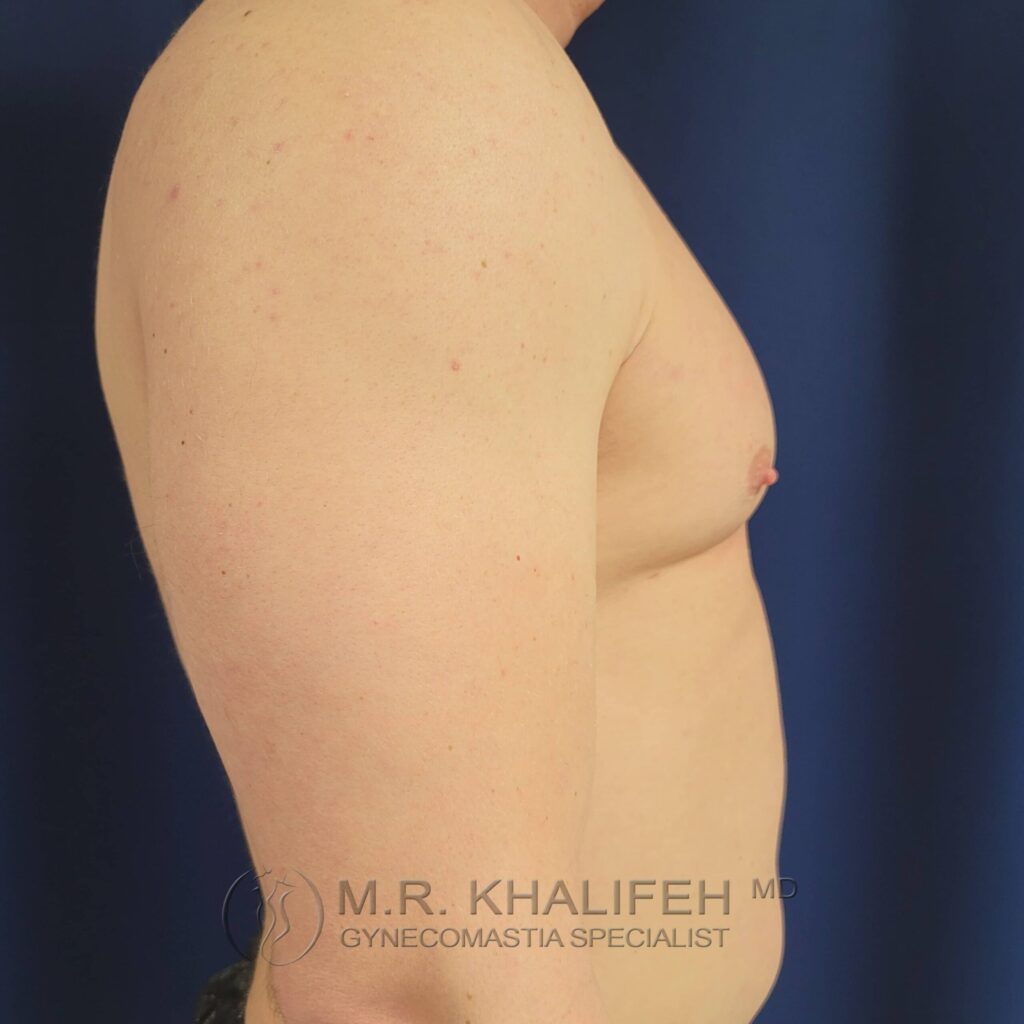 1655235180 pre 5 2 1 scaled 1.jpg