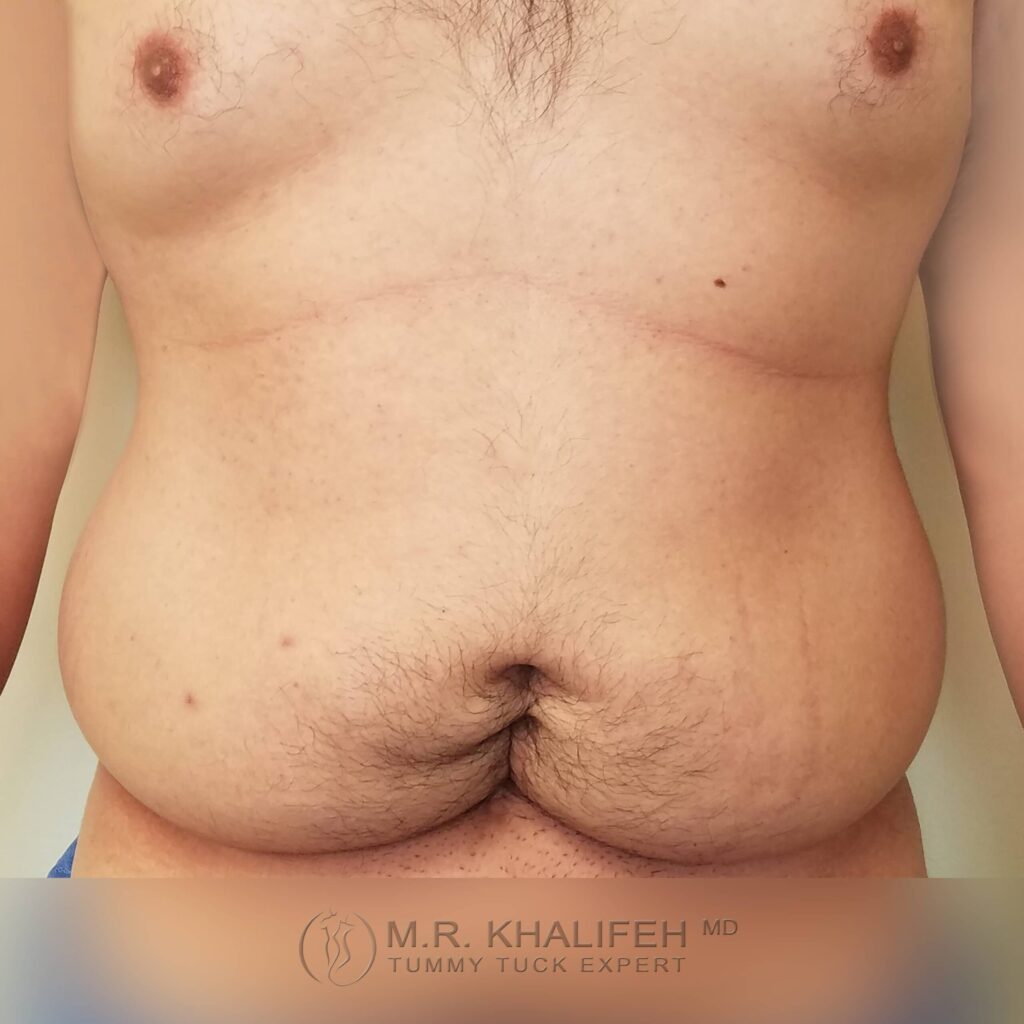1655471501 pre 4 1 scaled 1.jpg