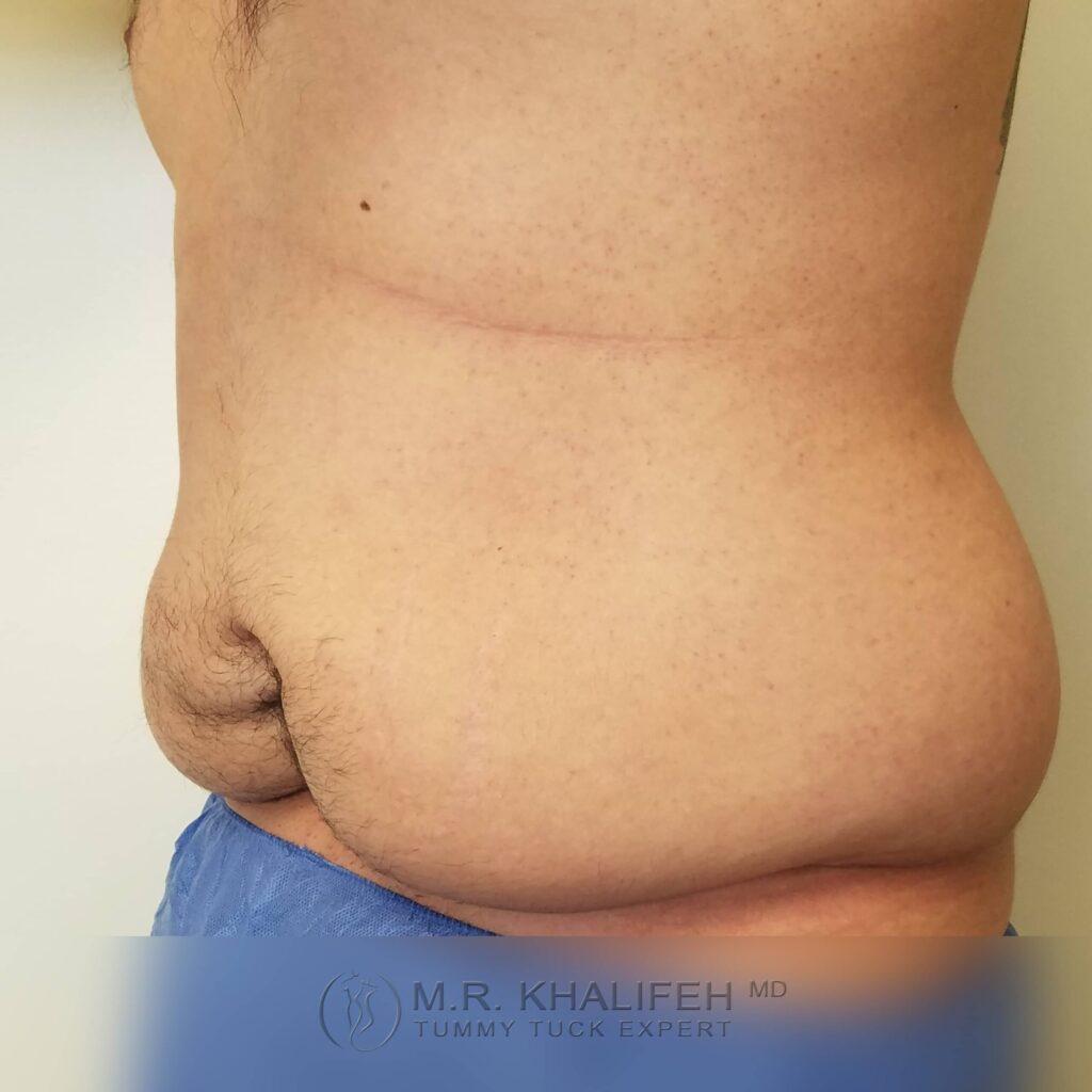 1655471507 pre 3 scaled 1.jpg