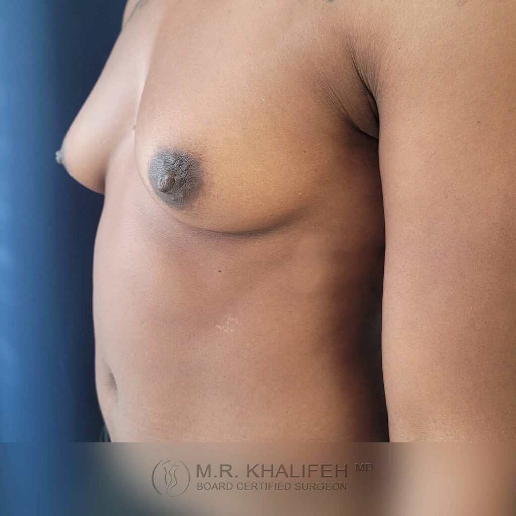 1656016503 pre 2 4 scaled 1.jpg