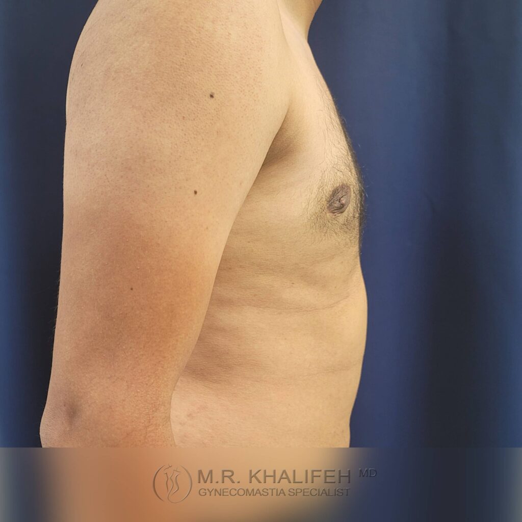 1656016945 post 1 5 scaled 1.jpg